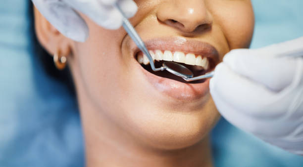 Best Broken Tooth Emergency  in Choccolocco, AL